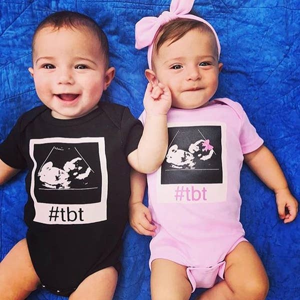 Pink #TBT sonogram baby onesie front view showing ultrasound image design